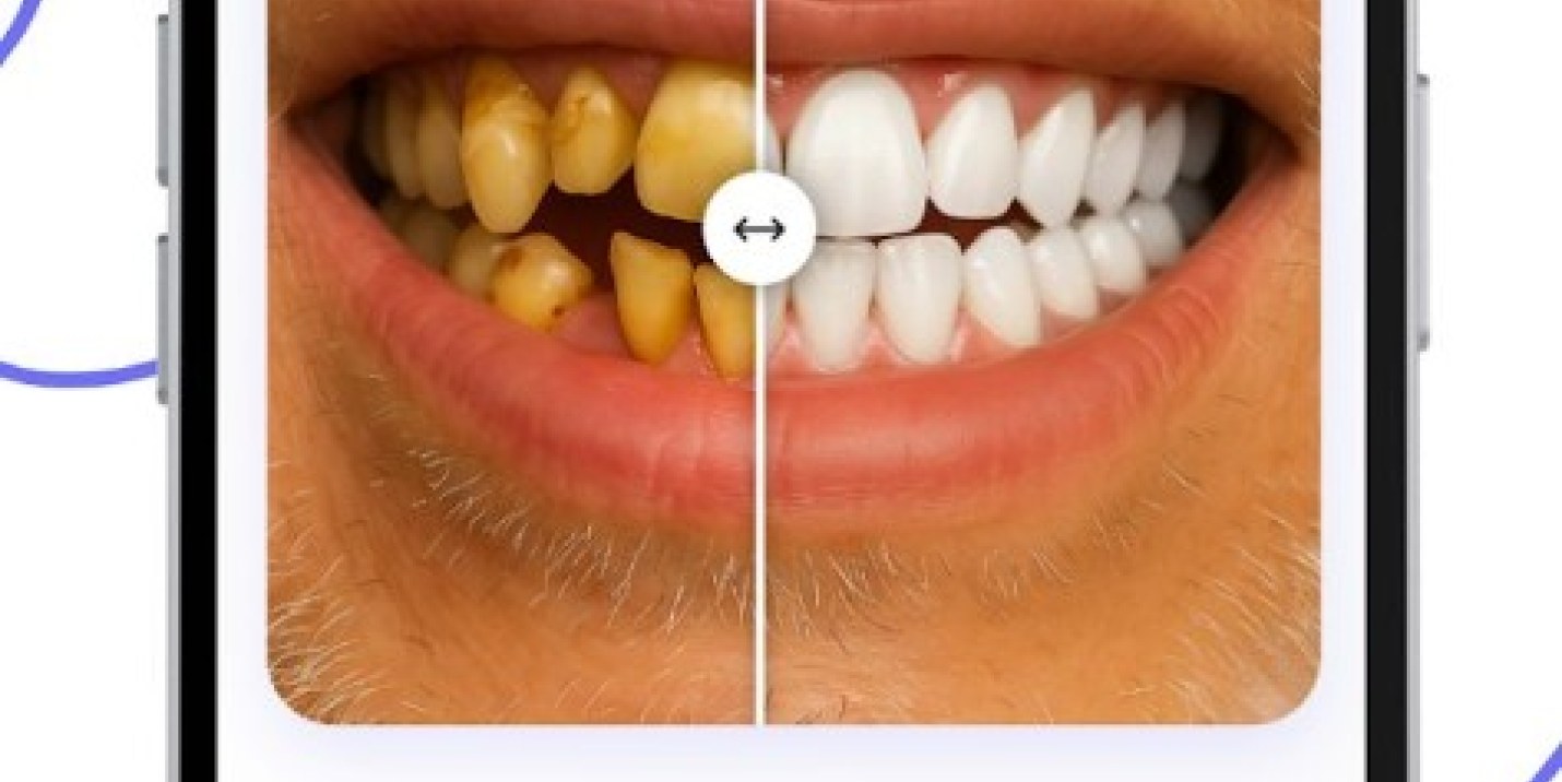 Teethsi app screenshot