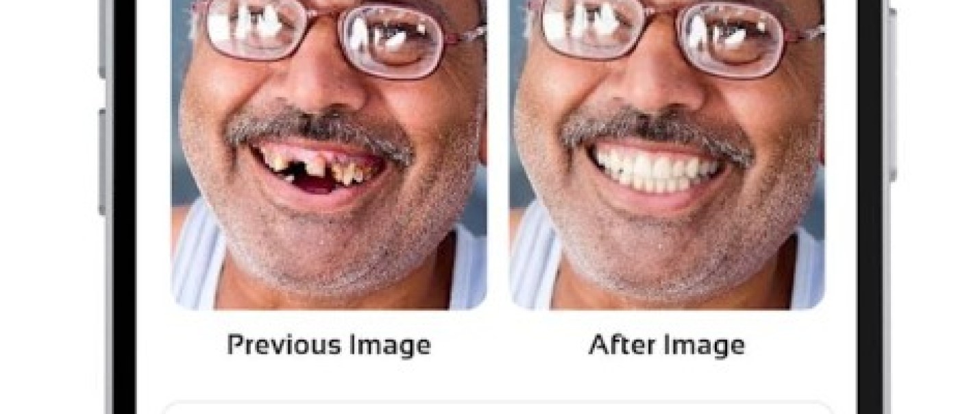 Teethsi